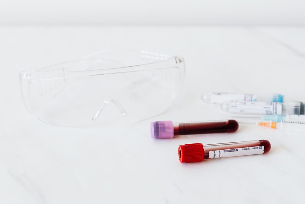 Test tubes for blood work and medical equipment sit on a white surface