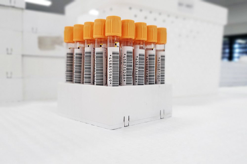 Blood Test specimens in test tubes sit in a lab.